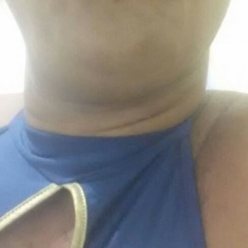 Alita